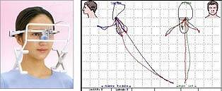 先進的な設備を用いた咬合調整