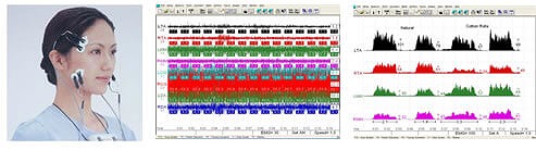 先進的な設備を用いた咬合調整